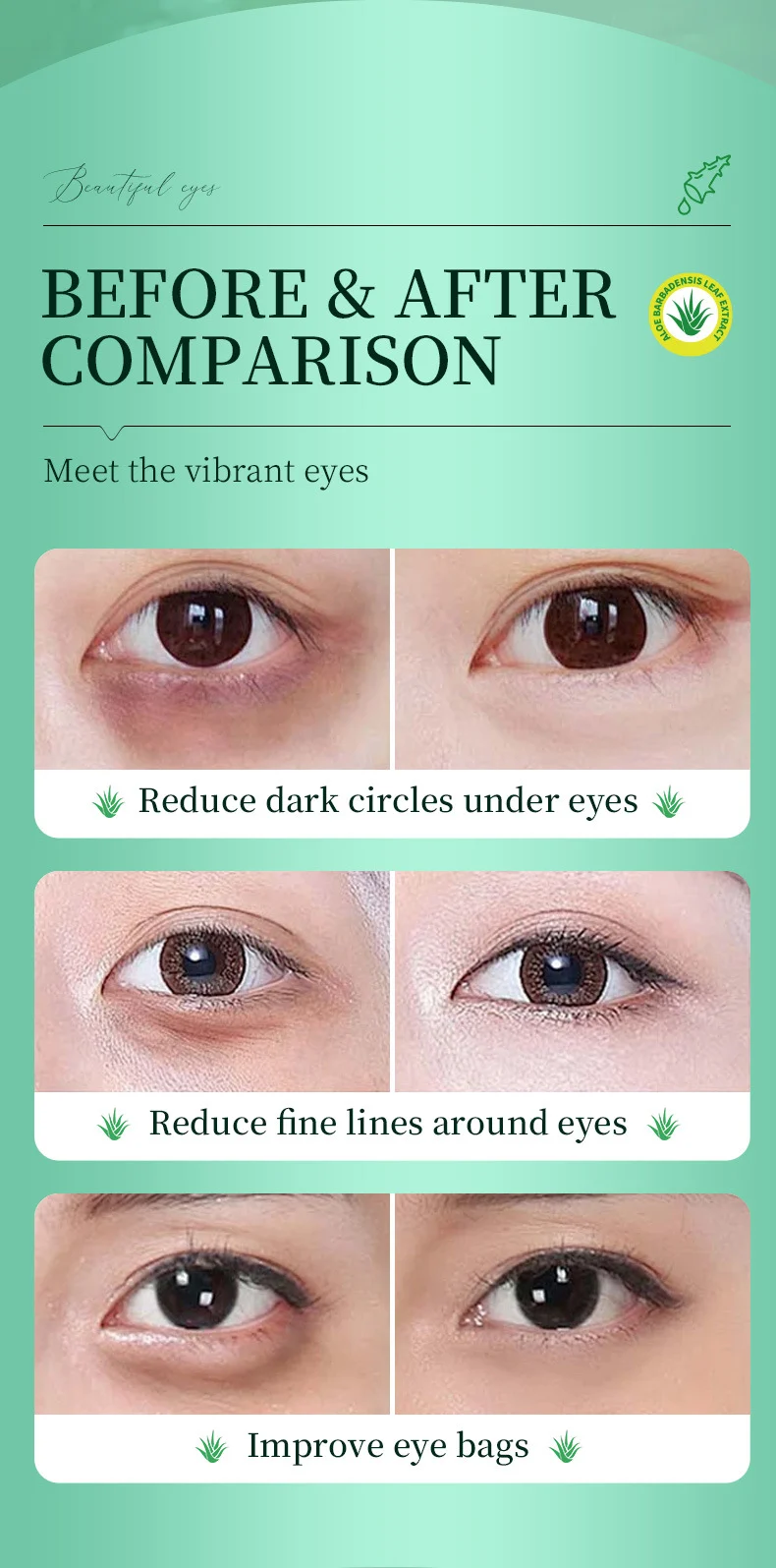 MOIKA Aloe Vera Eye Serum for Dark Circles & Fine Lines, 30ml 7 aloe vera eye serum spu878710479112 desc 7