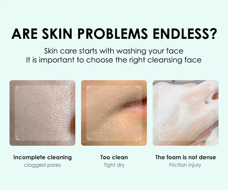 MOIKA Amino Acid Cleanser 100g - Gentle Hydrating Face Wash with Citrus VC 2 amino acid cleanser spu736468611276 desc 2