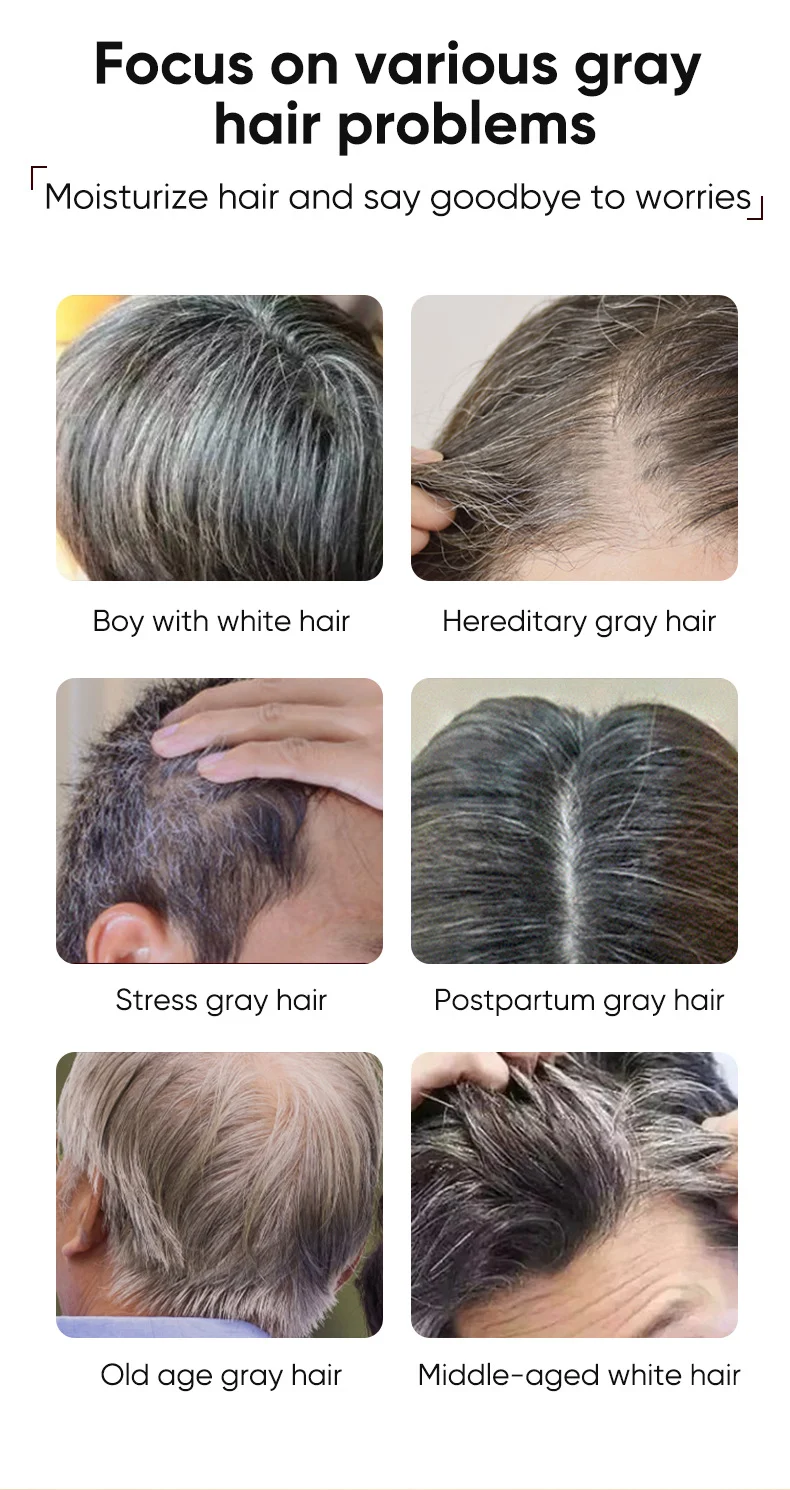 MOIKA Black Hair Essence Herbal Care Improves White Hair Nourishes Hair Roots 2 black hair essence spu727363552098 desc 2