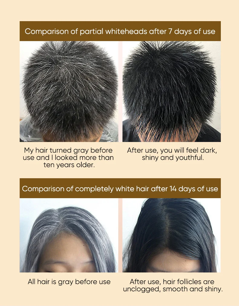 MOIKA Black Hair Essence Herbal Care Improves White Hair Nourishes Hair Roots 8 black hair essence spu727363552098 desc 8