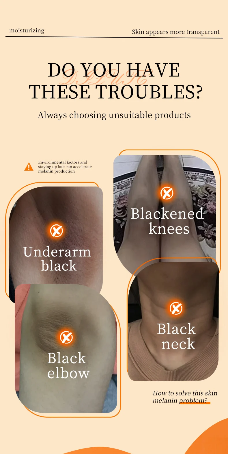 MOIKA Dark Spot Removal Cream for Underarm, Elbows & Knees, 60g 3 dark spot removal cream spu877926030282 desc 3