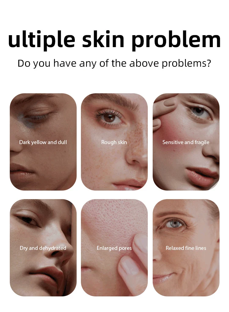 MOIKA Fruit Cartoon Facial Mask Set - 9 Different Masks for Brightening, Hydrating, Firming 2 fruit cartoon facial mask set spu760249186720 desc 2