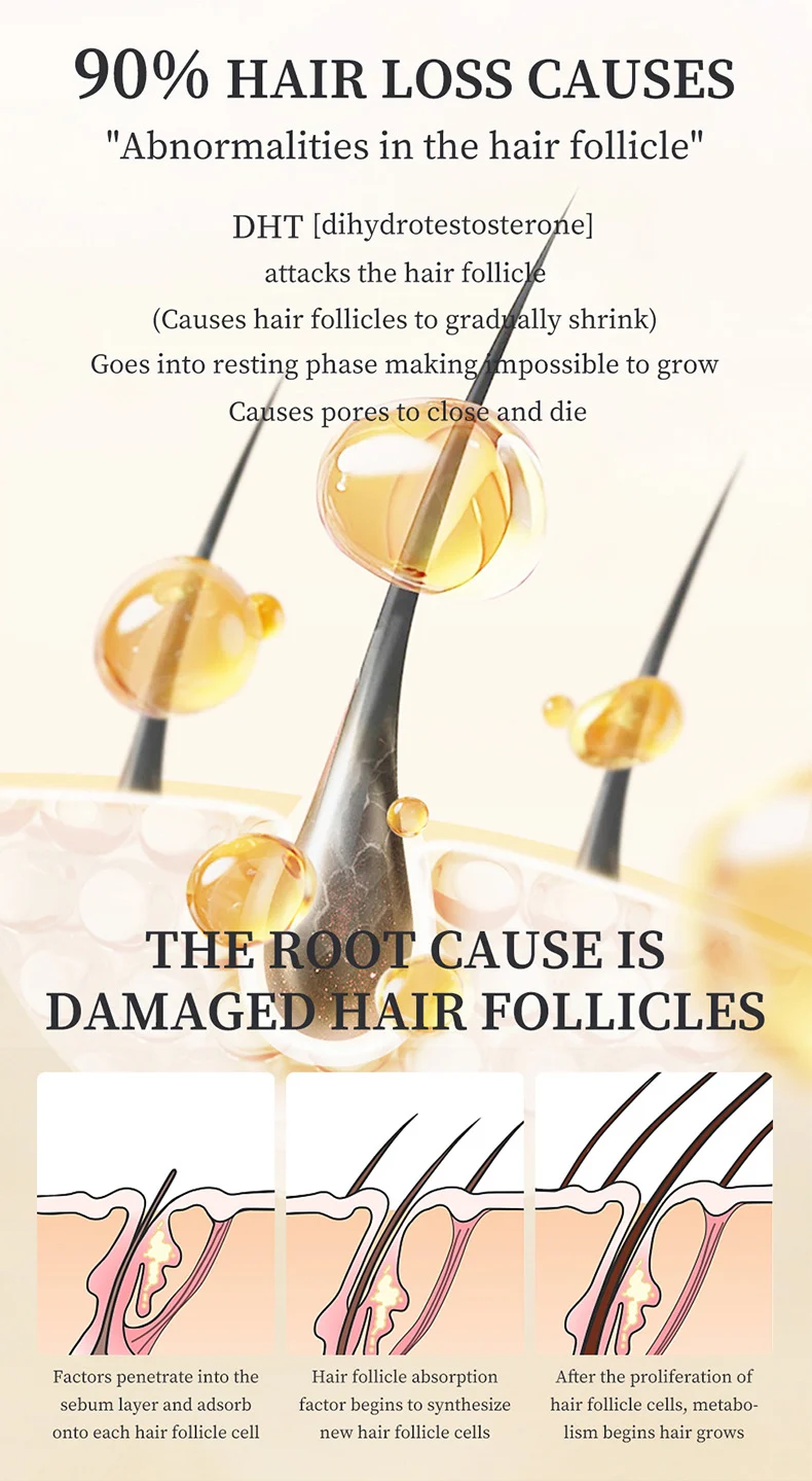 MOIKA Hair Growth Serum for Anti Hair Loss & Hair Regeneration, 30ml 4 hair growth anti loss serum spu917029835264 desc 4