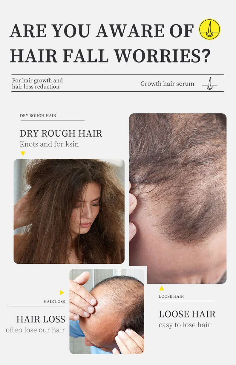 MOIKA Hair Growth Serum 30ml for Hair Loss Reduction and Strengthening 2 hair growth serreum spu731784409858 desc 2