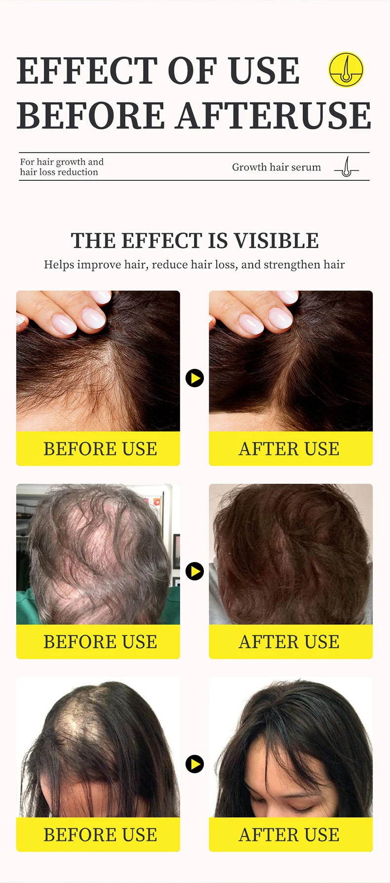 MOIKA Hair Growth Serum 30ml for Hair Loss Reduction and Strengthening 8 hair growth serreum spu731784409858 desc 8