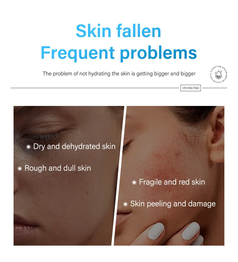 MOIKA Sodium Hyaluronate Hydrating Cream for Moisturizing Dry Skin 2 hyaluronic acid moisturizing cream spu732751716393 desc 2