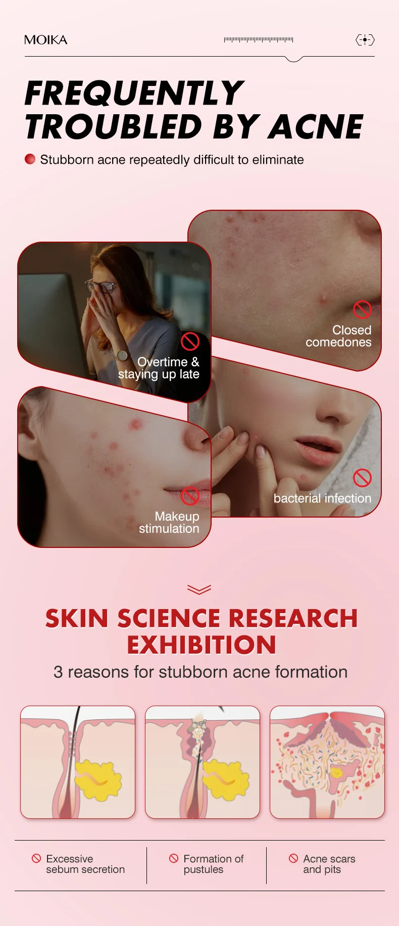 MOIKA Salicylic Acid Acne Patches 36 Pcs, Invisible Hydrocolloid Pimple Patch for Spot Treatment 2 hydrocolloid acne patches spu723137994867 desc 2