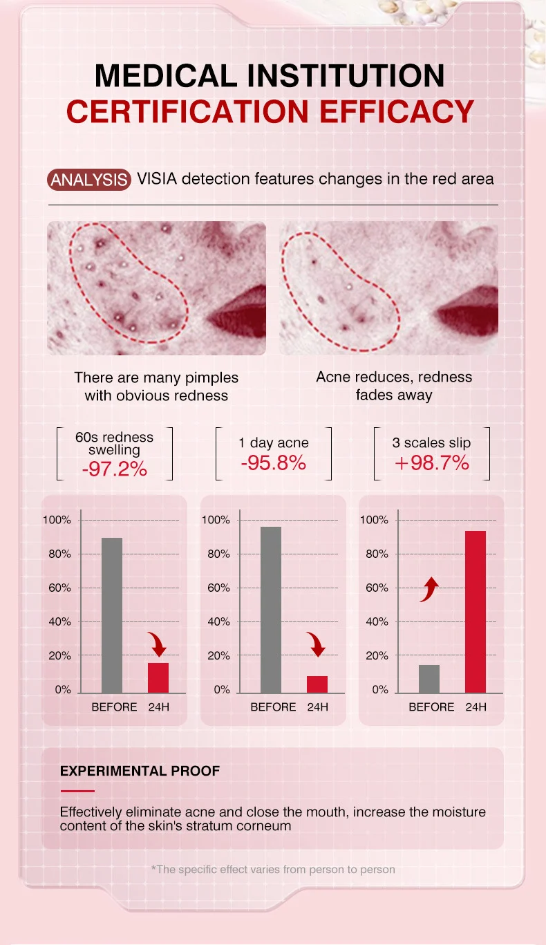 MOIKA Salicylic Acid Acne Patches 36 Pcs, Invisible Hydrocolloid Pimple Patch for Spot Treatment 5 hydrocolloid acne patches spu723137994867 desc 5