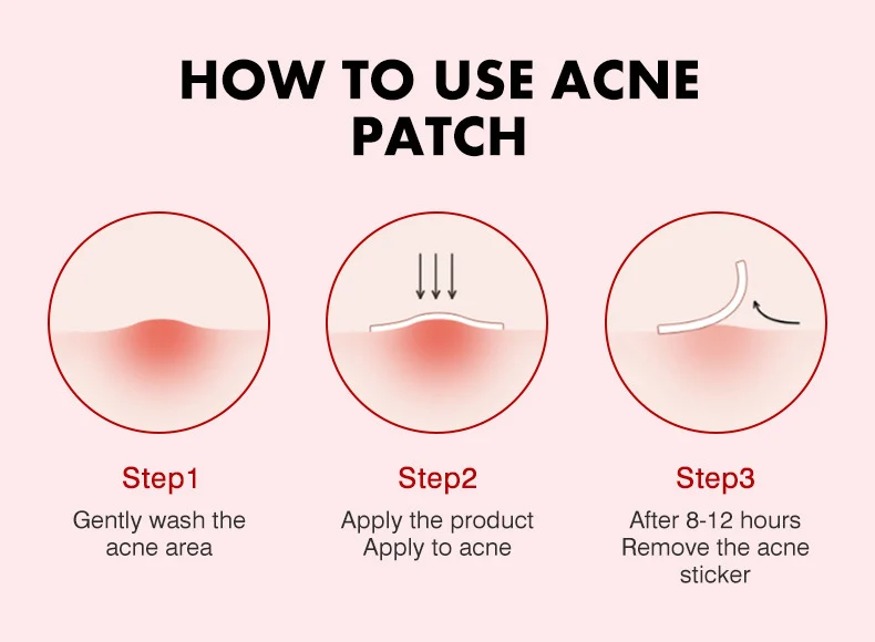 MOIKA Salicylic Acid Acne Patches 36 Pcs, Invisible Hydrocolloid Pimple Patch for Spot Treatment 9 hydrocolloid acne patches spu723137994867 desc 9