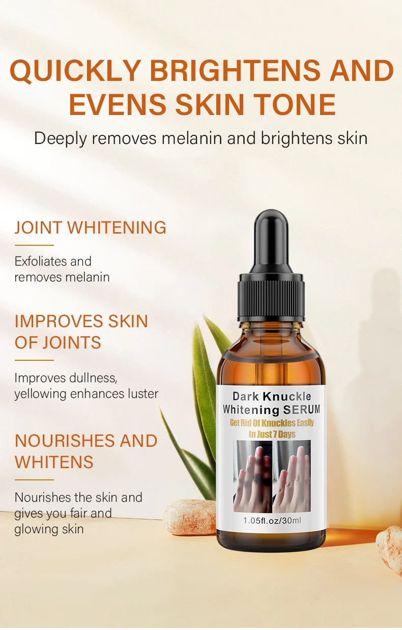 MOIKA Joint Whitening Serum for Knees, Hands & Elbows - Dark Spot Corrector 3 joint whitening serum spu693464638057 desc 3