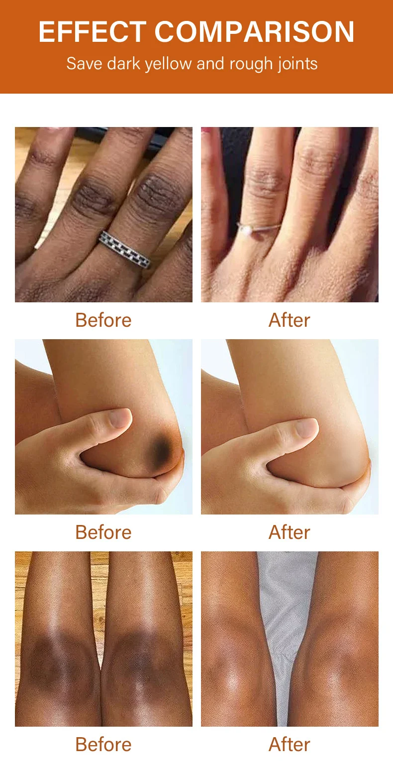 MOIKA Joint Whitening Serum for Knees, Hands & Elbows - Dark Spot Corrector 7 joint whitening serum spu693464638057 desc 7