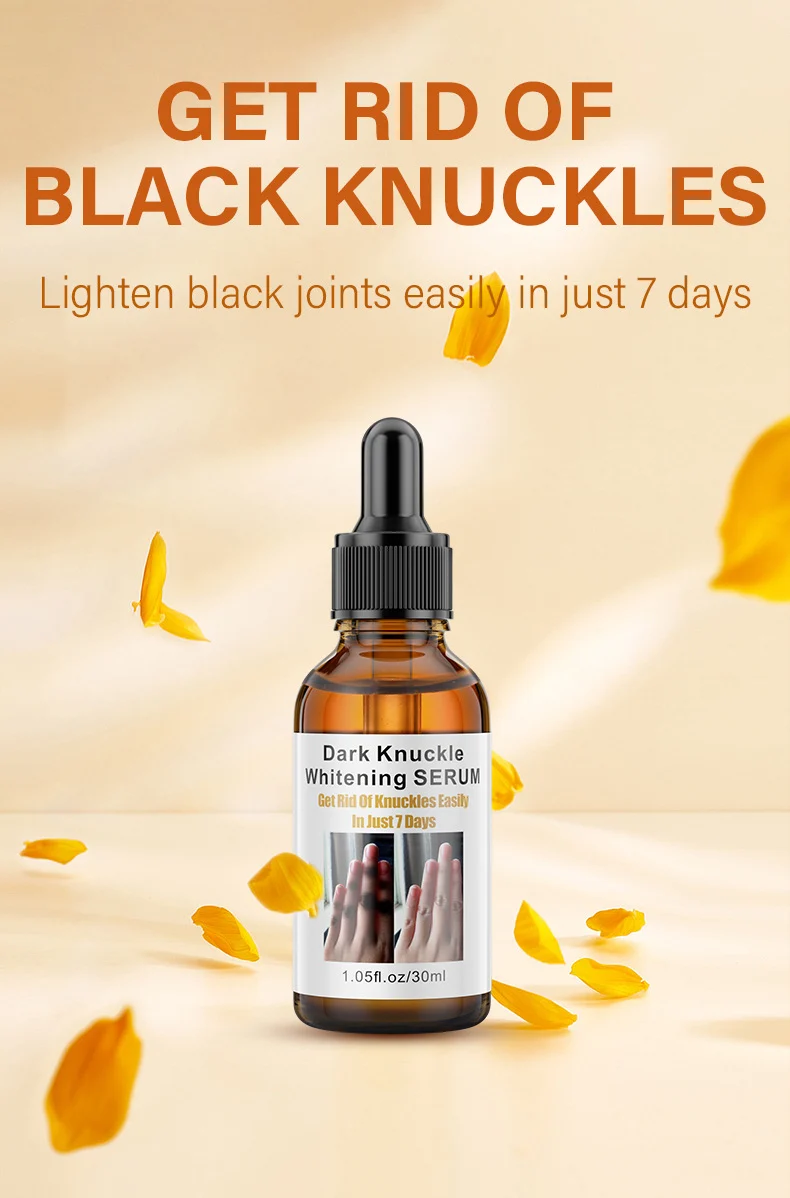 MOIKA Joint Whitening Serum 30ml Dark Knuckle & Knee Brightening Melanin Removal 1 joint whitening serum spu693747389670 desc 1
