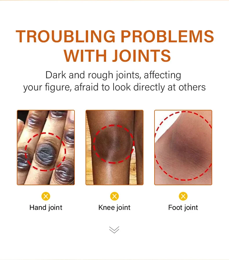 MOIKA Joint Whitening Serum 30ml Dark Knuckle & Knee Brightening Melanin Removal 2 joint whitening serum spu693747389670 desc 2