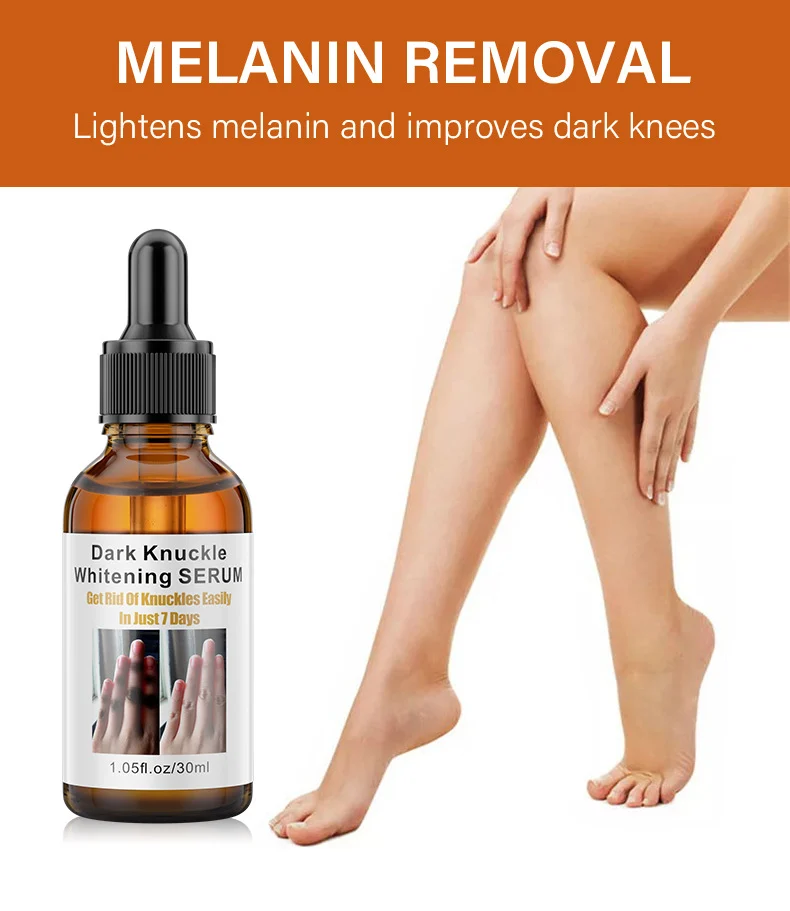 MOIKA Joint Whitening Serum 30ml Dark Knuckle & Knee Brightening Melanin Removal 5 joint whitening serum spu693747389670 desc 5
