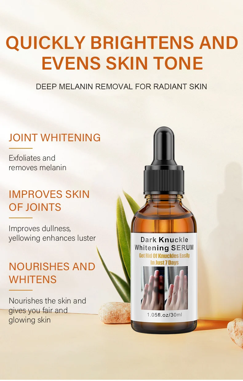 MOIKA Joint Darkening Serum for Elbows, Knees & Ankles, 30ml Whitening Treatment 2 joint whitening serum spu708105180464 desc 2