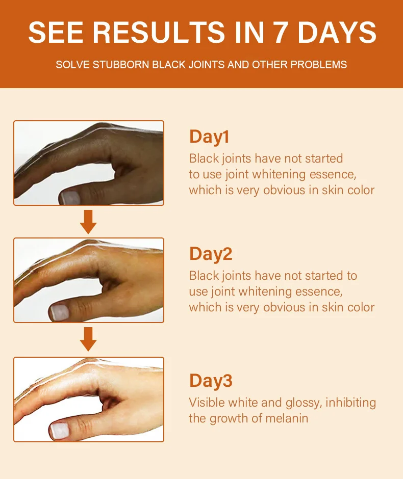 MOIKA Joint Darkening Serum for Elbows, Knees & Ankles, 30ml Whitening Treatment 5 joint whitening serum spu708105180464 desc 5