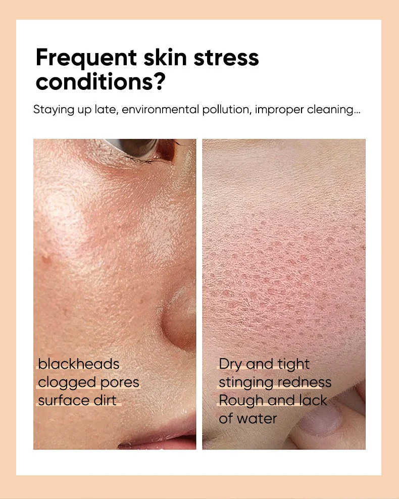 kojic acid glycolic acid toner spu975215542609 desc 4