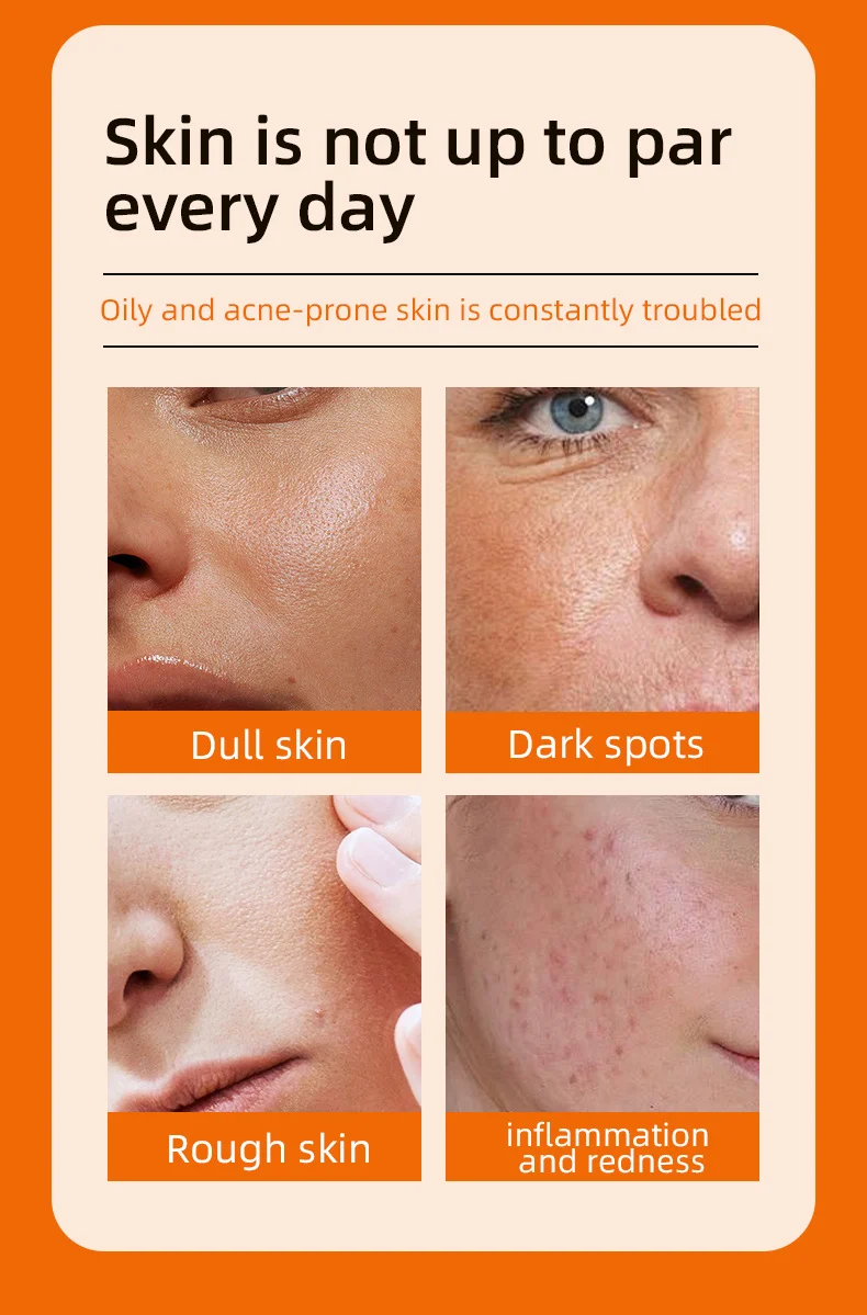 MOIKA Kojic Acid & Turmeric Cleansing Pads 50 Pads - Exfoliate Brighten Skin 2 kojic acid turmeric cleansing pads spu710413673258 desc 2