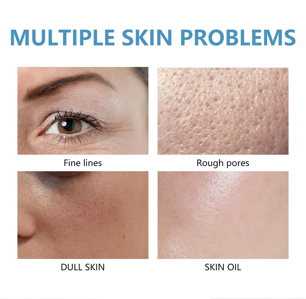 MOIKA Day and Night Cream Set 15g+15g Moisturizing Face Cream 2 moisturizing day night cream set spu741721446035 desc 2