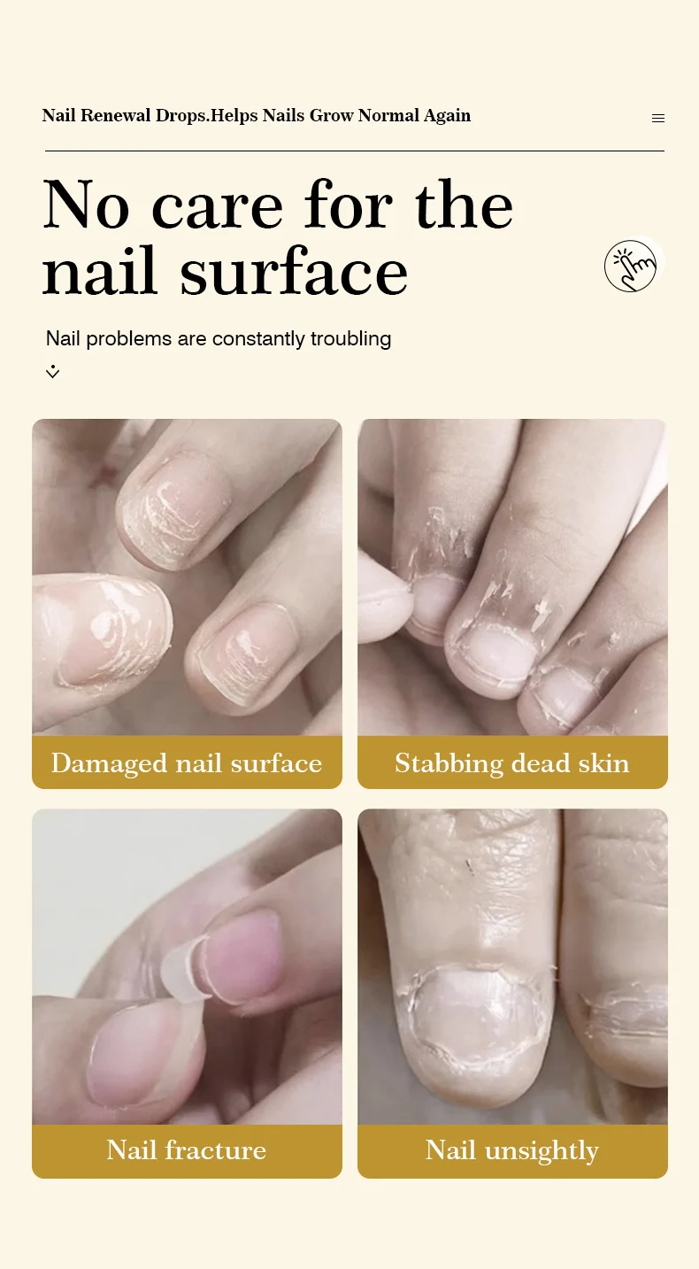 MOIKA Nail Renewal Drops for Damaged & Discolored Toenails Fingernails Growth Repair 2 nail renewal repair drops spu680691019616 desc 2