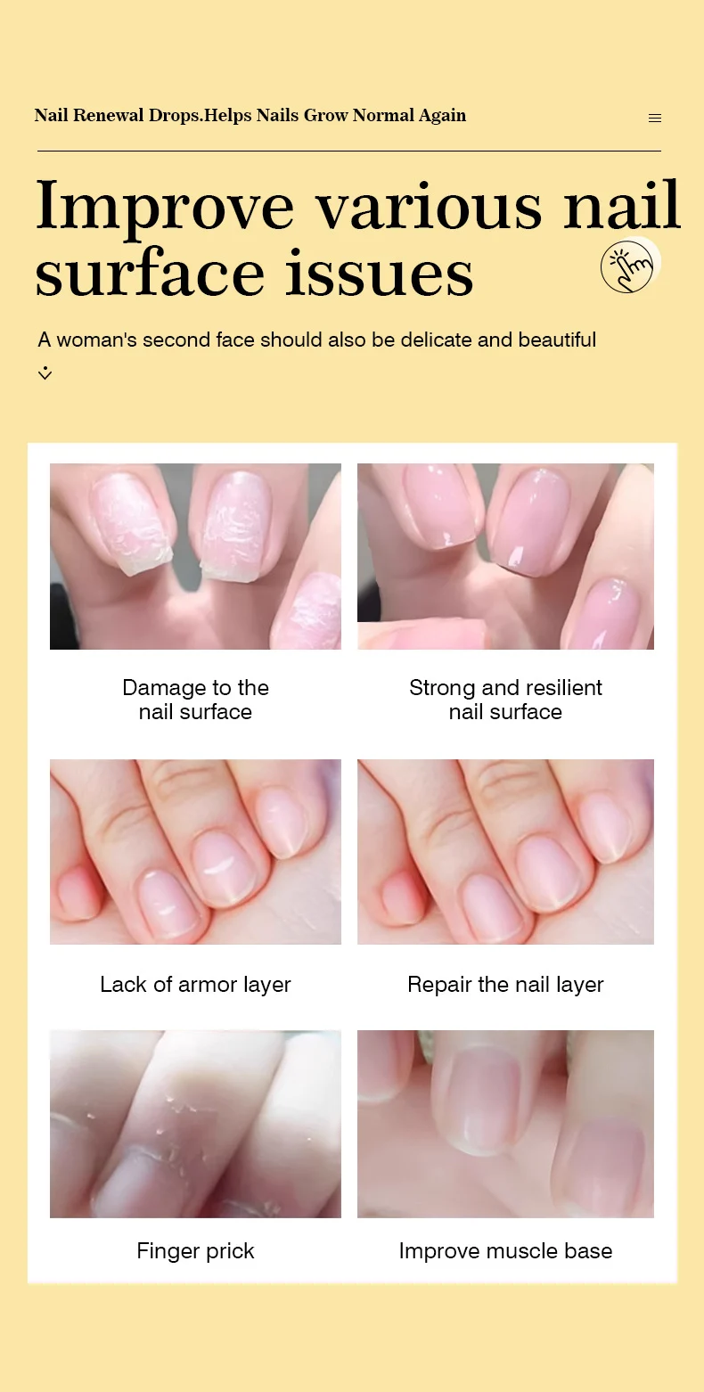 MOIKA Nail Renewal Drops for Damaged & Discolored Toenails Fingernails Growth Repair 6 nail renewal repair drops spu680691019616 desc 6