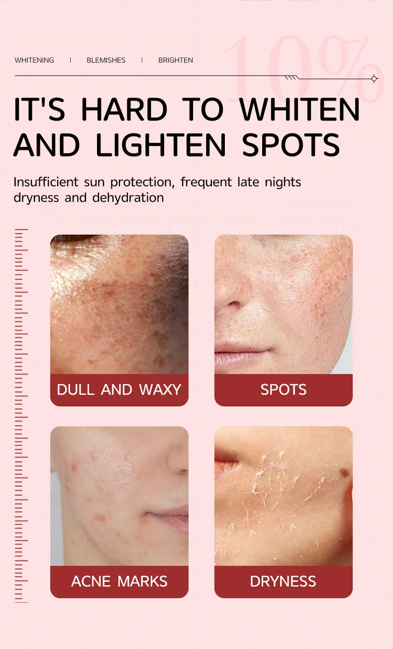 MOIKA Niacinamide 10% TXA 4% Serum for Dark Spots, Brightening & Blemish 2 niacinamide serum dark spot correction spu901541217129 desc 2