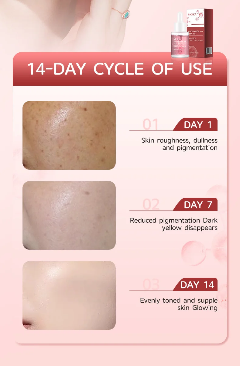MOIKA Niacinamide 10% TXA 4% Serum for Dark Spots, Brightening & Blemish 6 niacinamide serum dark spot correction spu901541217129 desc 6