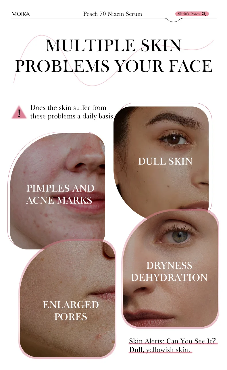 MOIKA Peach 70 Niacinamide Serum 30ml for Brightening & Hydrating Skin 2 niacinamide serum spu727219576521 desc 2