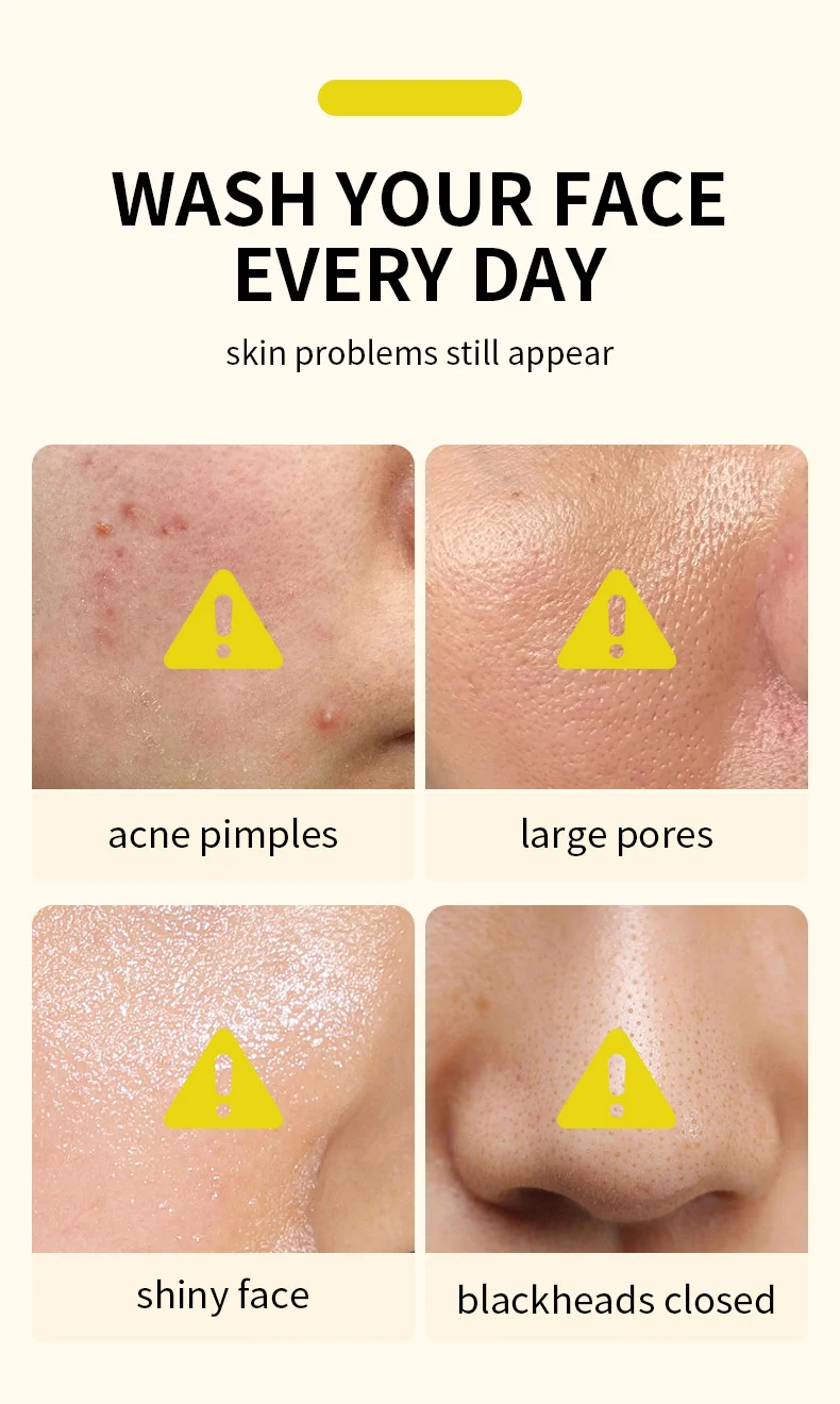 MOIKA Salicylic Acid 2% Acne Removing Essence Serum, Oil Control & Brightening 2 salicylic acid acne removing serum spu672389144657 desc 2