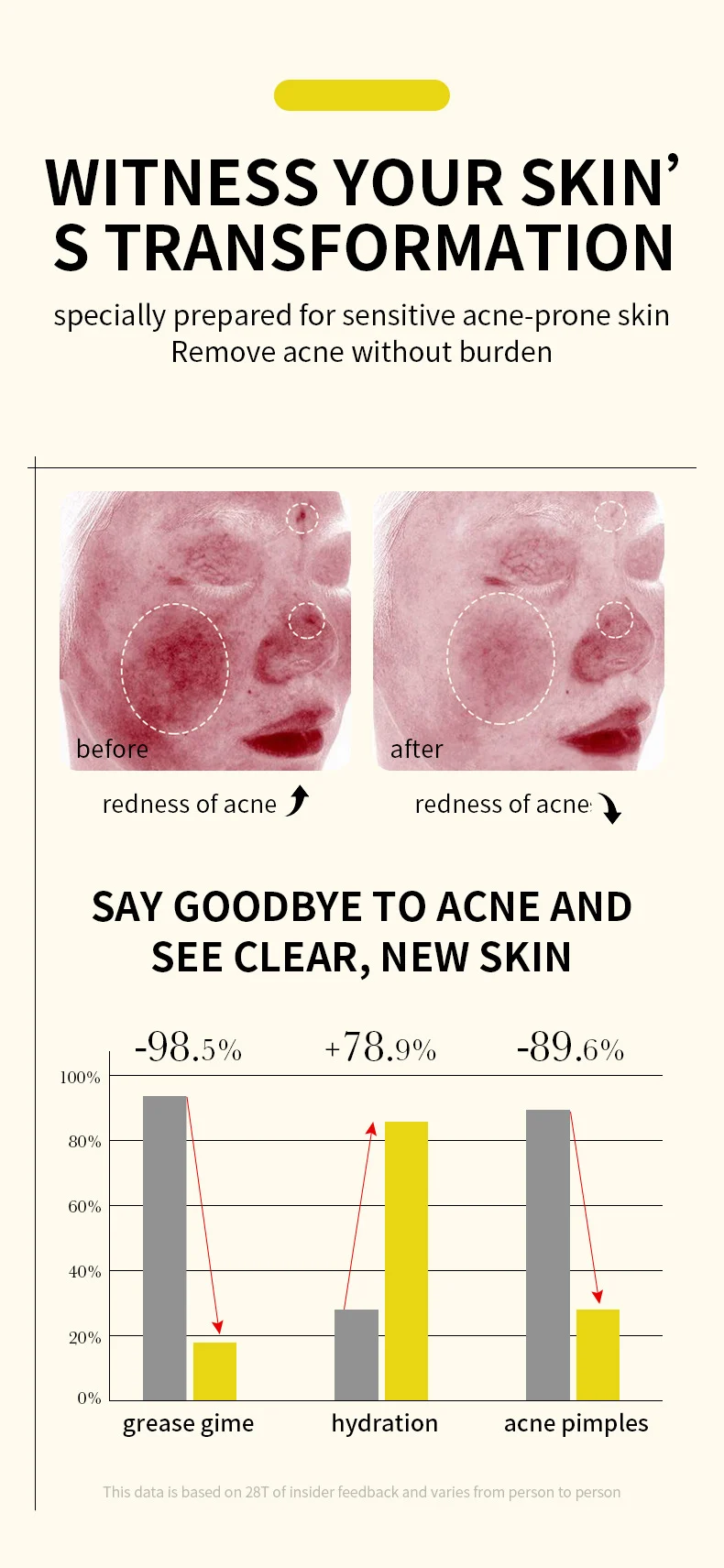 MOIKA Salicylic Acid 2% Acne Removing Essence Serum, Oil Control & Brightening 5 salicylic acid acne removing serum spu672389144657 desc 5