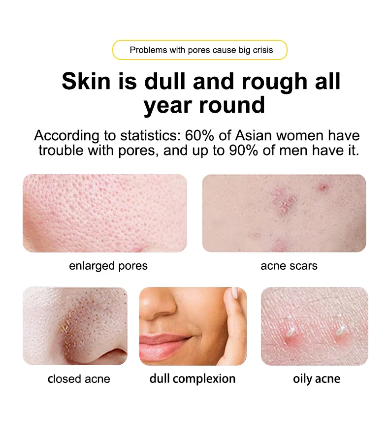 MOIKA Salicylic Acid 2% Acne Removing Essence Water for Oily Skin 2 salicylic acid acne treatment essence spu672396284544 desc 2