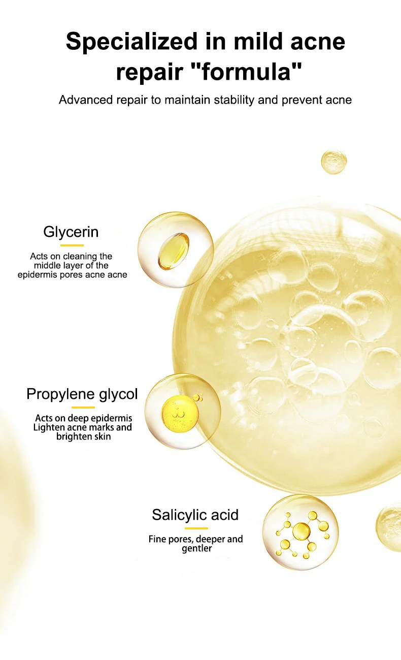 MOIKA Salicylic Acid 2% Acne Removing Essence Water for Oily Skin 4 salicylic acid acne treatment essence spu672396284544 desc 4