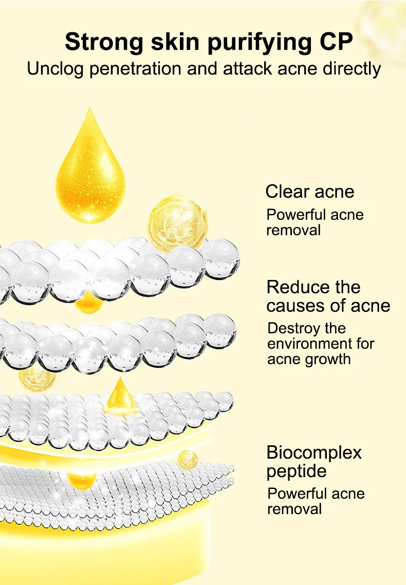 MOIKA Salicylic Acid 2% Acne Removing Essence Water for Oily Skin 5 salicylic acid acne treatment essence spu672396284544 desc 5