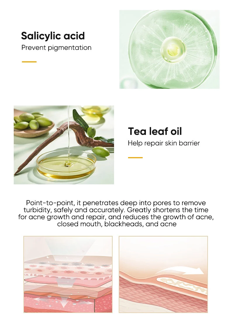 salicylic acne essence gel spu765871426565 desc 5