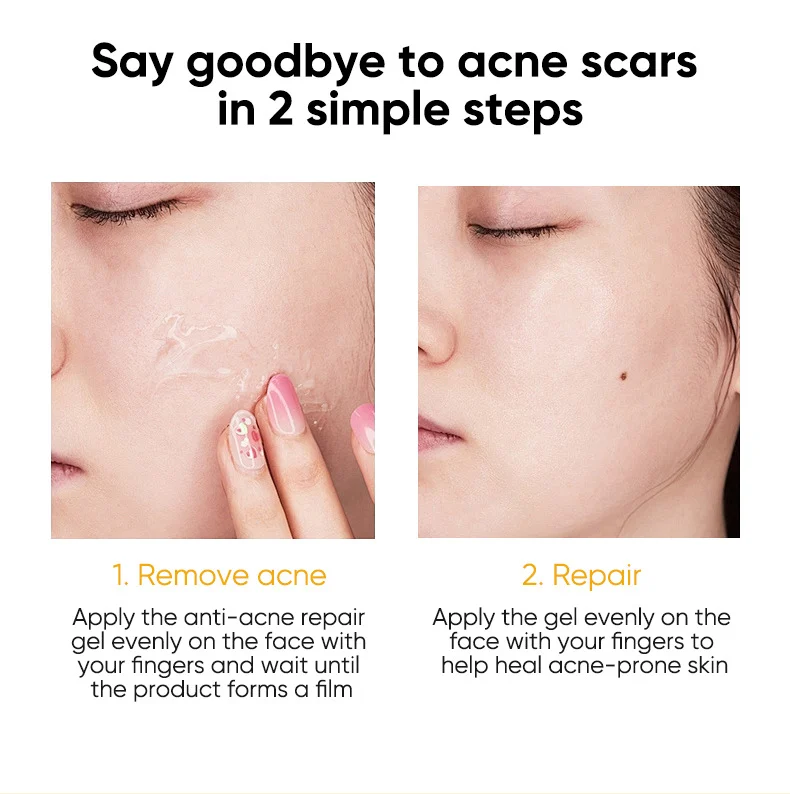 salicylic acne essence gel spu765871426565 desc 8