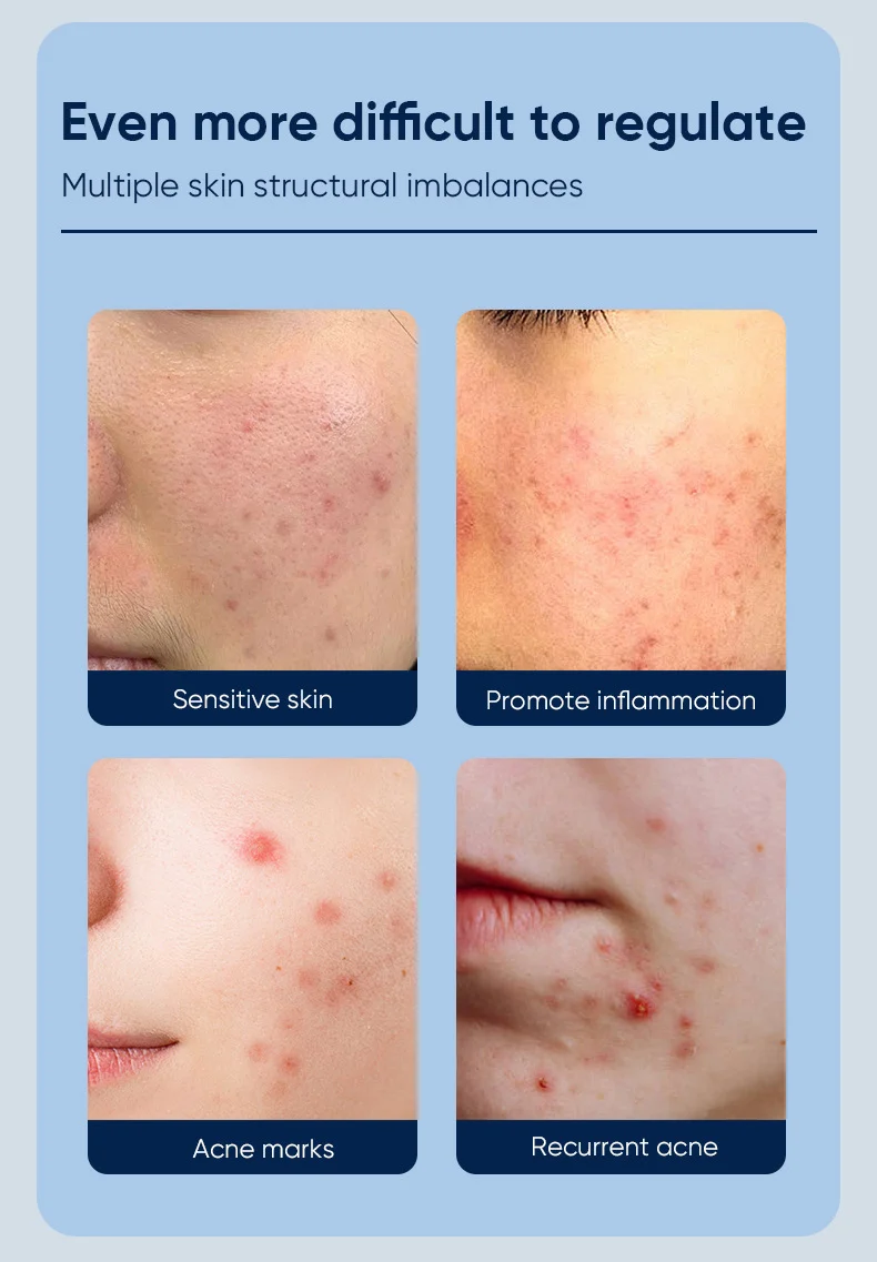 salicylic acne essence gel spu818110711715 desc 2