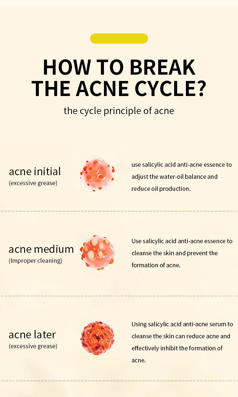 salicylic acne removing serum spu764637554094 desc 3