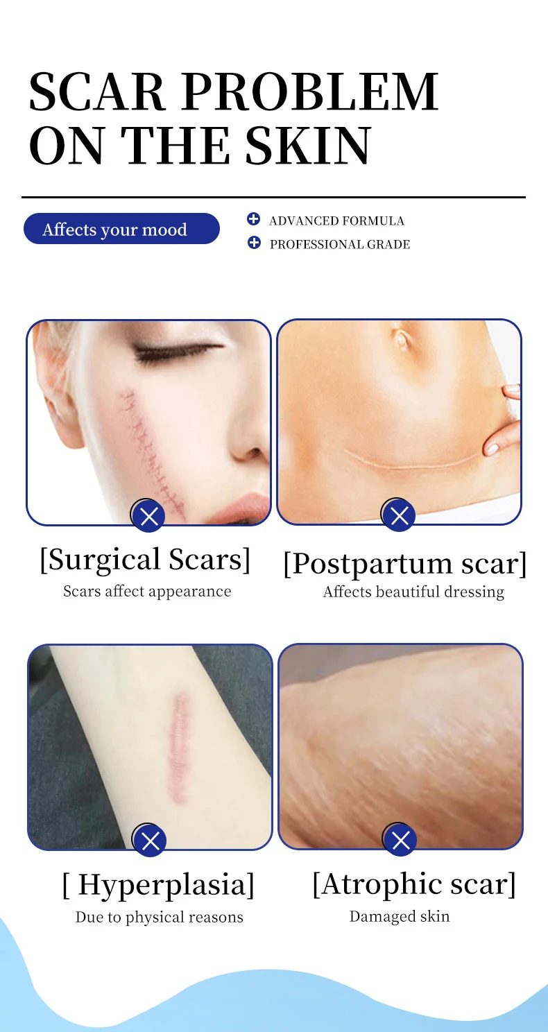 silicone scar cream spu887073298651 desc 2