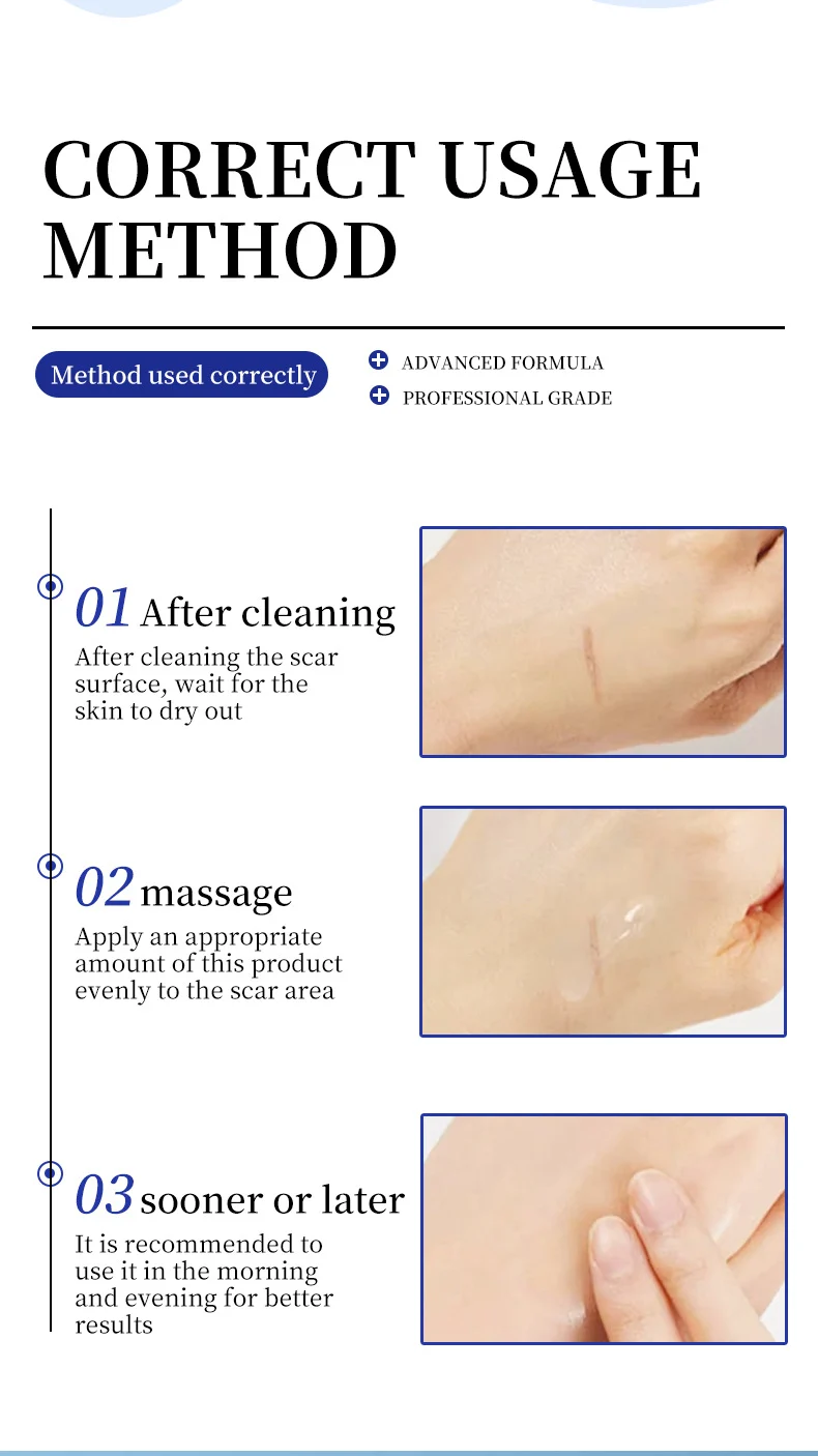 silicone scar cream spu887073298651 desc 7