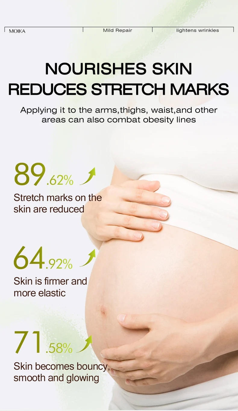 MOIKA Deep Mild Repair Stretch Mark Cream for Pregnancy & Postpartum 7 stretch mark repair cream spu704286310208 desc 7