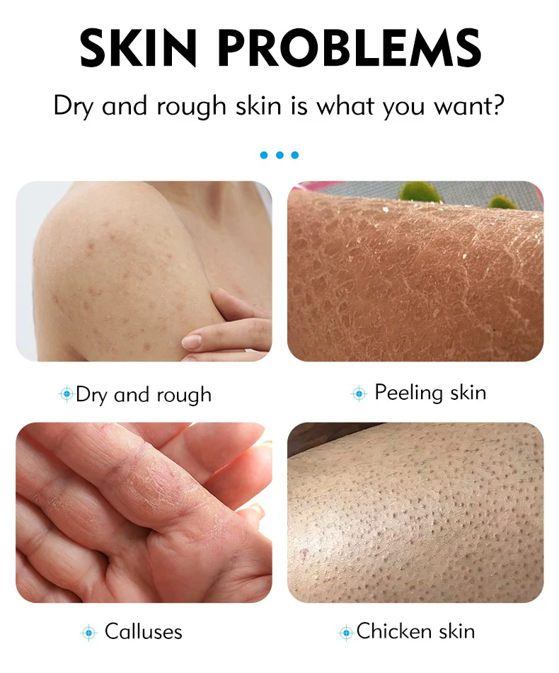 MOIKA 40% Urea Cream with 2% Salicylic Acid for Rough Dry Cracked Skin 2 urea salycylic acid moisturizing cream spu670322416965 desc 2