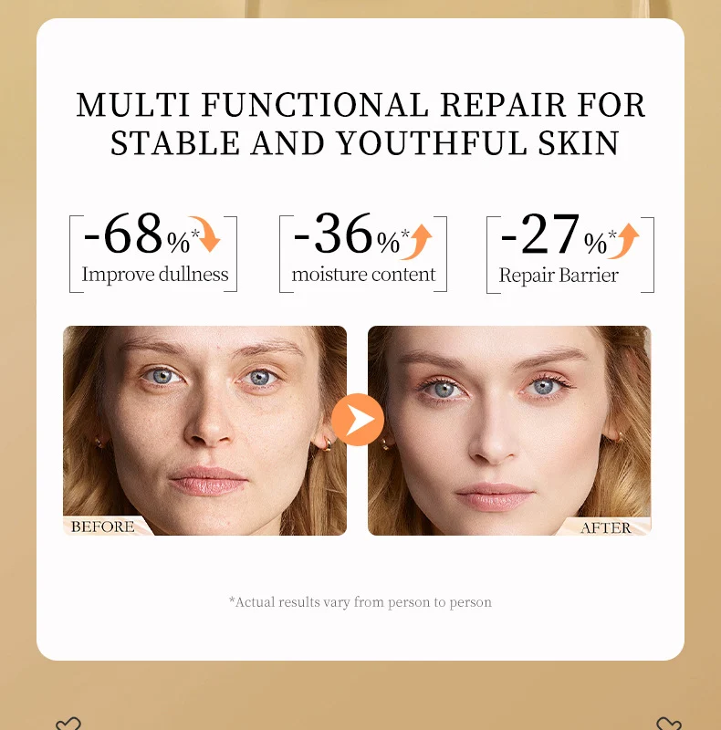 MOIKA Whitening Freckle Removing Essence 10% Neurocool-Amine & NAG 10 whitening freckle removing essence spu763505296180 desc 10