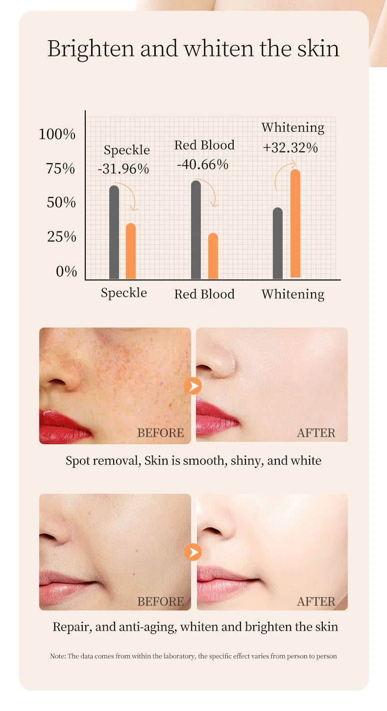 MOIKA Whitening Freckle Removing Essence 10% Neurocool-Amine & NAG 5 whitening freckle removing essence spu763505296180 desc 5