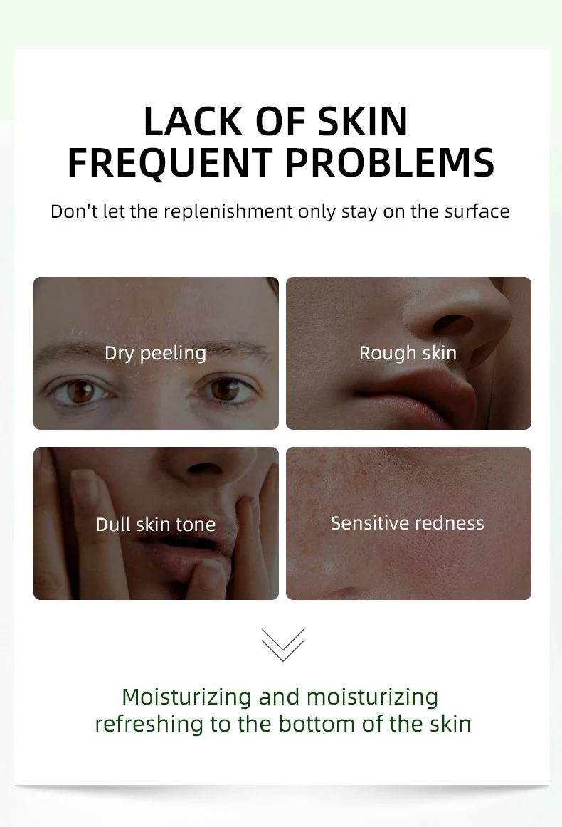 MOIKA Whitening Vitamin E Body Cream for Moisturizing & Brightening 2 whitening vitamin e body cream spu744670549451 desc 2